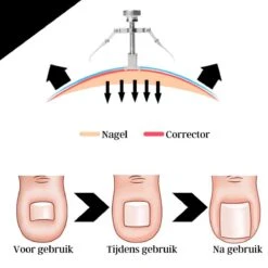 Merkloos STARMAN 7-delige Pedicure En Manicure Set - Nagelknipper - Pedicureset - Nagelvijl - Nageltang - Kalknagel - Teennagelknipper 16 Merkloos STARMAN 7-delige Pedicure En Manicure Set - Nagelknipper - Pedicureset - Nagelvijl - Nageltang - Kalknagel - Teennagelknipper -Beroemde Cosmetica Winkel 1200x1200 518