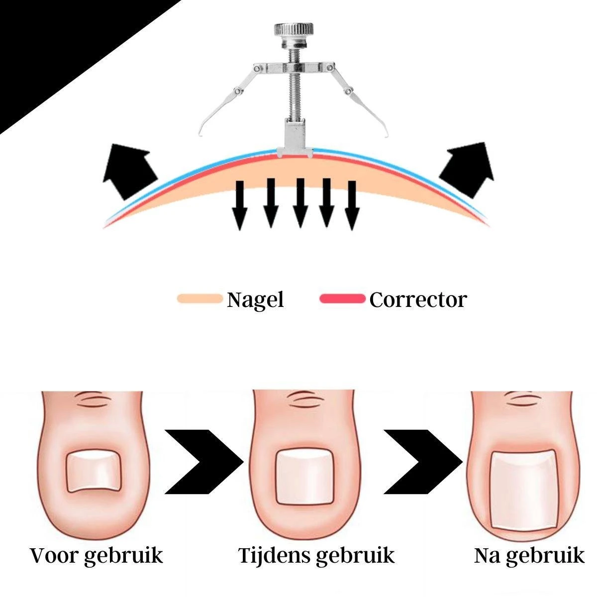 Merkloos STARMAN 7-delige Pedicure En Manicure Set - Nagelknipper - Pedicureset - Nagelvijl - Nageltang - Kalknagel - Teennagelknipper 8 Merkloos STARMAN 7-delige Pedicure En Manicure Set - Nagelknipper - Pedicureset - Nagelvijl - Nageltang - Kalknagel - Teennagelknipper - Afbeelding 6