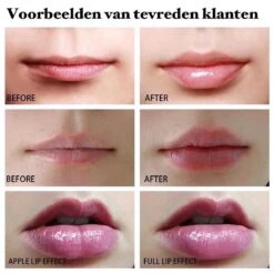 BenjaBeauty Lip Plumper - Lippen - Lipstick - Lippenbalsem - Rood - Wit -Beroemde Cosmetica Winkel 1200x1200 939