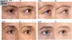 L'Oréal Paris Clinically Proven Wimperserum - 2 Ml 24 L'Oréal Paris Clinically Proven Wimperserum - 2 Ml -Beroemde Cosmetica Winkel 1200x670 1