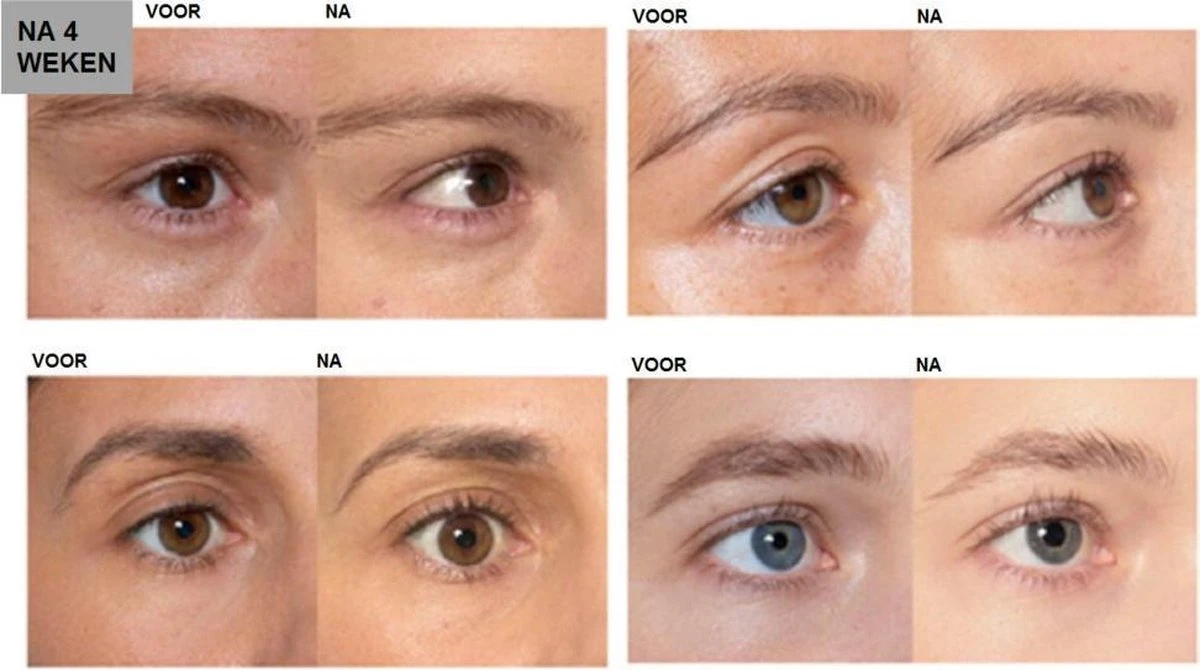 L'Oréal Paris Clinically Proven Wimperserum - 2 Ml 7 L'Oréal Paris Clinically Proven Wimperserum - 2 Ml - Afbeelding 5