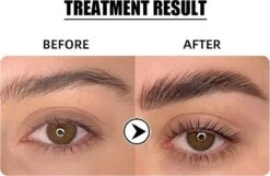 Flora Ruby - Wimper & Wenkbrauw Lifting Set 2 In 1 - Professionele 2 In 1 Lash Lift & Brow Lamination Kit - Permanente Wimperkruller -Beroemde Cosmetica Winkel 1200x782 2